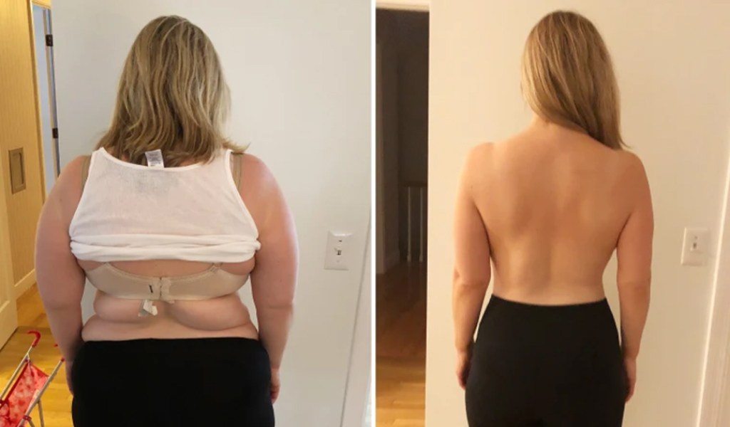 Снижение объемов и массы тела у пациентки